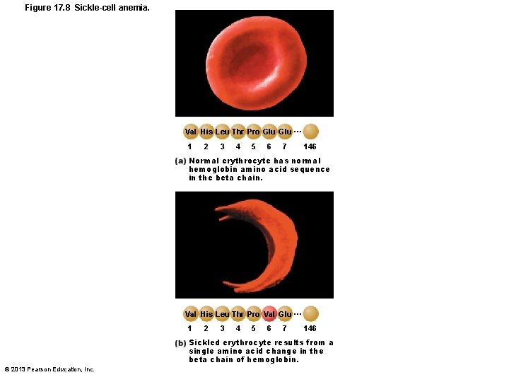 Figure 17. 8 Sickle-cell anemia. Val His Leu Thr Pro Glu … 1 2