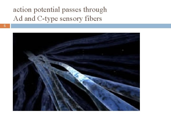action potential passes through Ad and C-type sensory fibers 6 