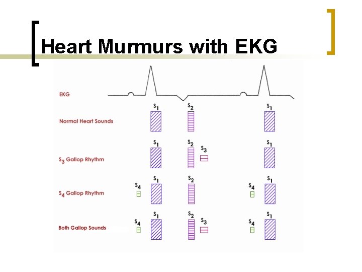 Heart Murmurs with EKG 