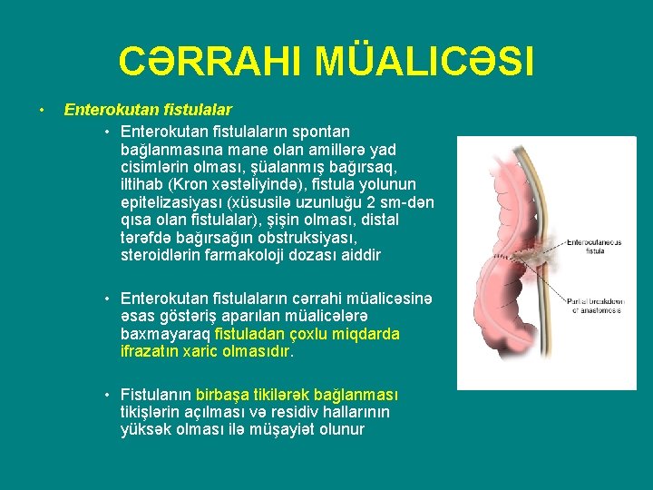 CƏRRAHI MÜALICƏSI • Enterokutan fistulalar • Enterokutan fistulaların spontan bağlanmasına mane olan amillərə yad