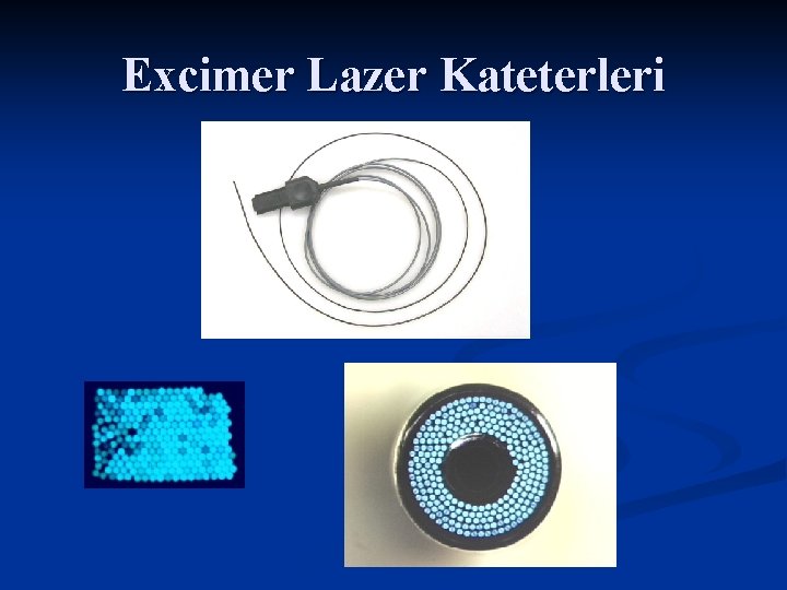 Excimer Lazer Kateterleri 