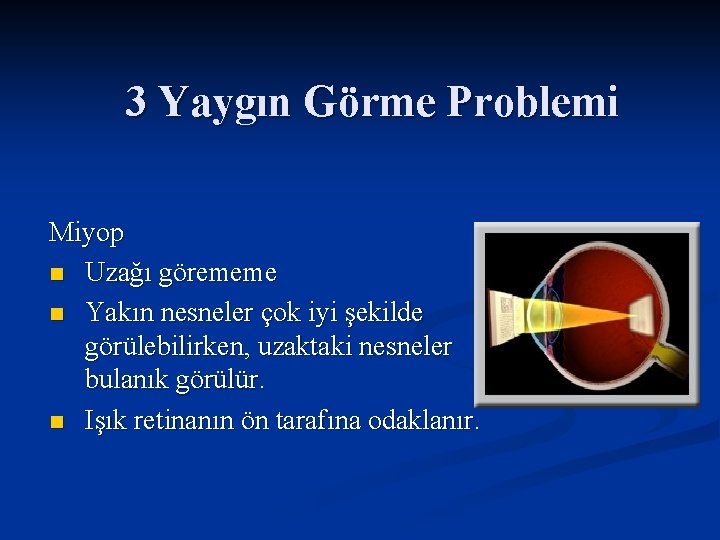 3 Yaygın Görme Problemi Miyop n Uzağı görememe n Yakın nesneler çok iyi şekilde