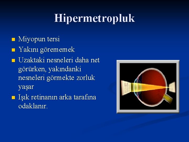 Hipermetropluk n n Miyopun tersi Yakını görememek Uzaktaki nesneleri daha net görürken, yakındanki nesneleri