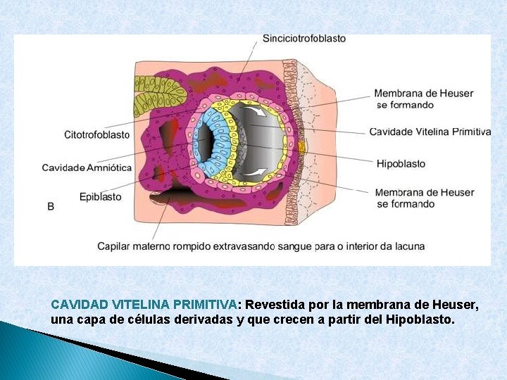 CAVIDAD VITELINA PRIMITIVA: Revestida por la membrana de Heuser, una capa de células derivadas