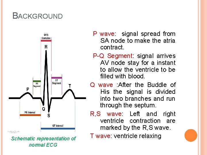 BACKGROUND Schematic representation of normal ECG P wave: signal spread from SA node to