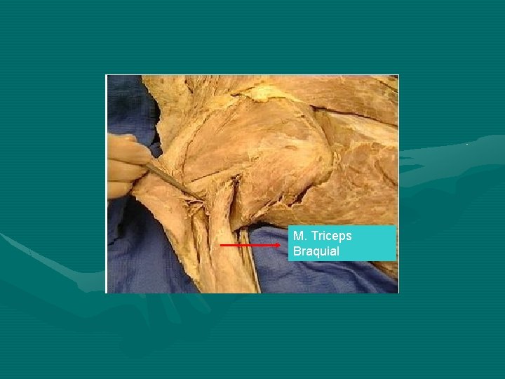 M. Triceps Braquial 