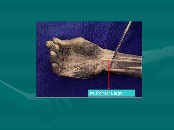 M. Palmar Largo 