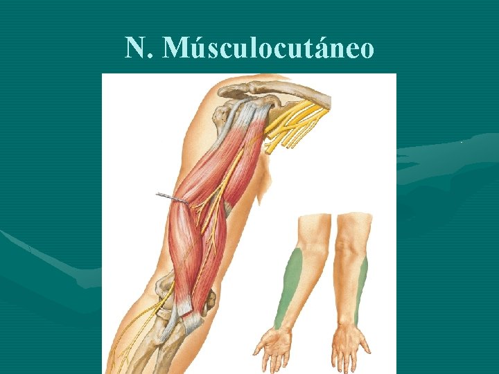 N. Músculocutáneo 