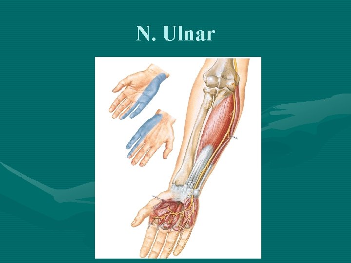 N. Ulnar 