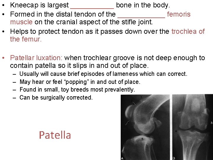  • Kneecap is largest ______ bone in the body. • Formed in the