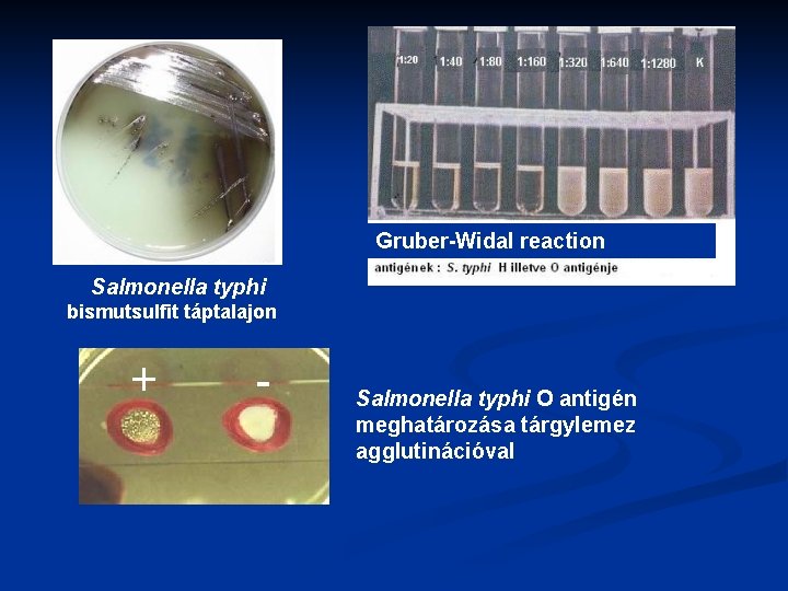 Gruber-Widal reaction Salmonella typhi bismutsulfit táptalajon + - Salmonella typhi O antigén meghatározása tárgylemez