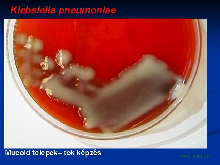 Klebsiella pneumoniae Mucoid telepek– tok képzés www. icbm. de 