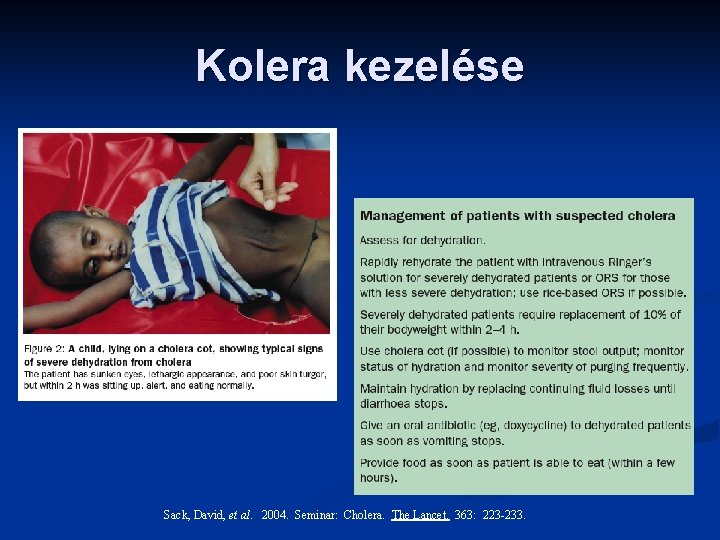 Kolera kezelése Sack, David, et al. 2004. Seminar: Cholera. The Lancet. 363: 223 -233.