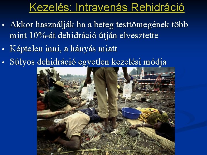 Kezelés: Intravenás Rehidráció • • • Akkor használják ha a beteg testtömegének több mint