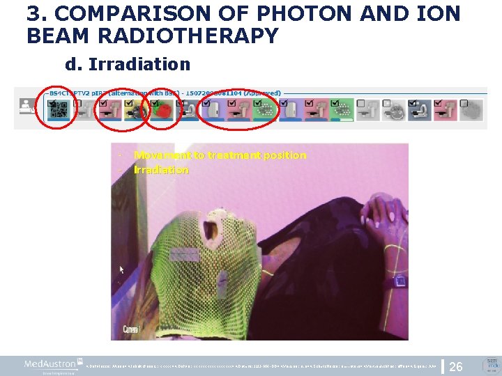 3. COMPARISON OF PHOTON AND ION BEAM RADIOTHERAPY d. Irradiation -Patient Movement to treatment