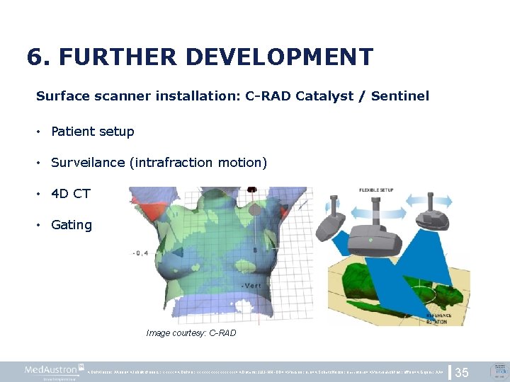 6. FURTHER DEVELOPMENT Surface scanner installation: C-RAD Catalyst / Sentinel • Patient setup •