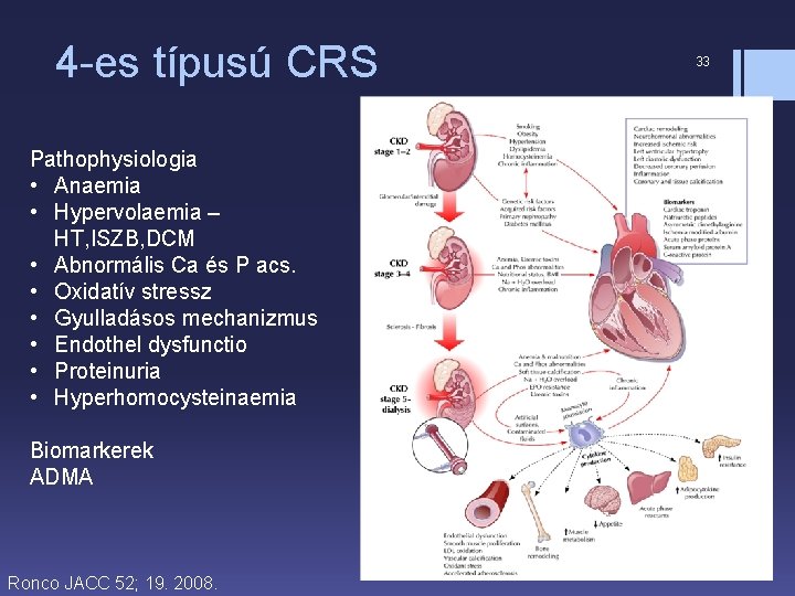 4 -es típusú CRS Pathophysiologia • Anaemia • Hypervolaemia – HT, ISZB, DCM •