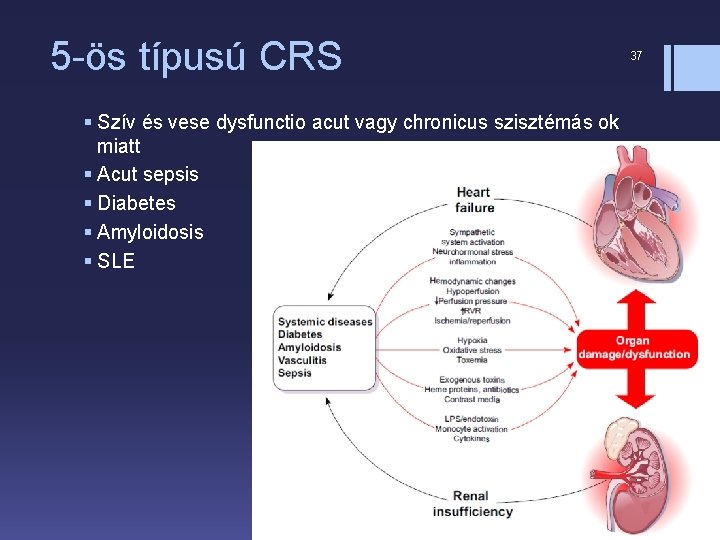 5 -ös típusú CRS § Szív és vese dysfunctio acut vagy chronicus szisztémás ok