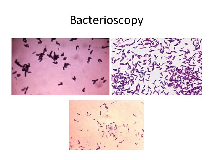 Bacterioscopy 