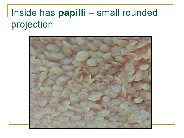 Inside has papilli – small rounded projection 