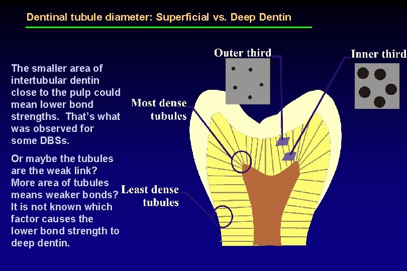 Dentinal tubule diameter: Superficial vs. Deep Dentin The smaller area of intertubular dentin close