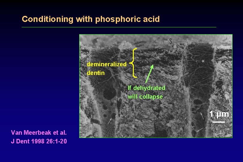 Conditioning with phosphoric acid demineralized dentin If dehydrated will collapse 1 μm Van Meerbeak