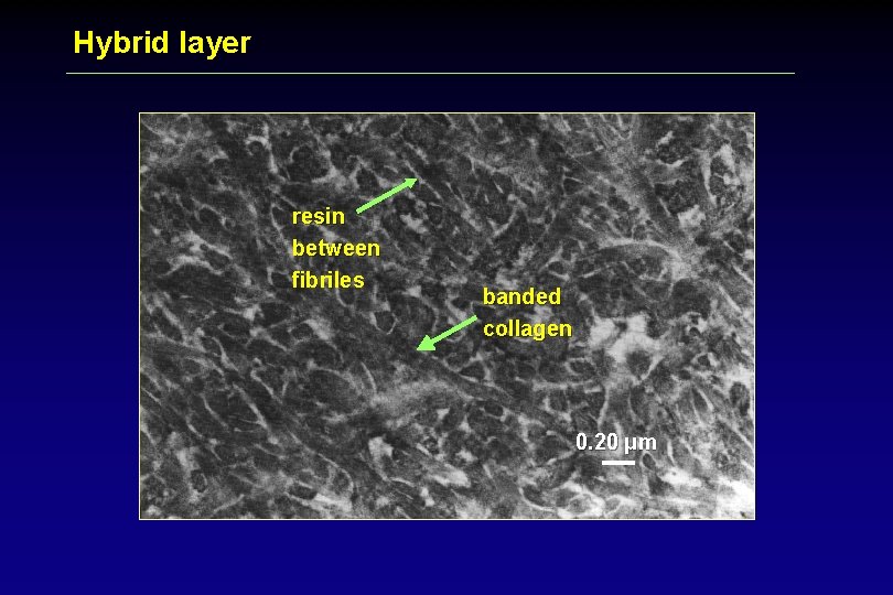 Hybrid layer resin between fibriles banded collagen 0. 20 μm 