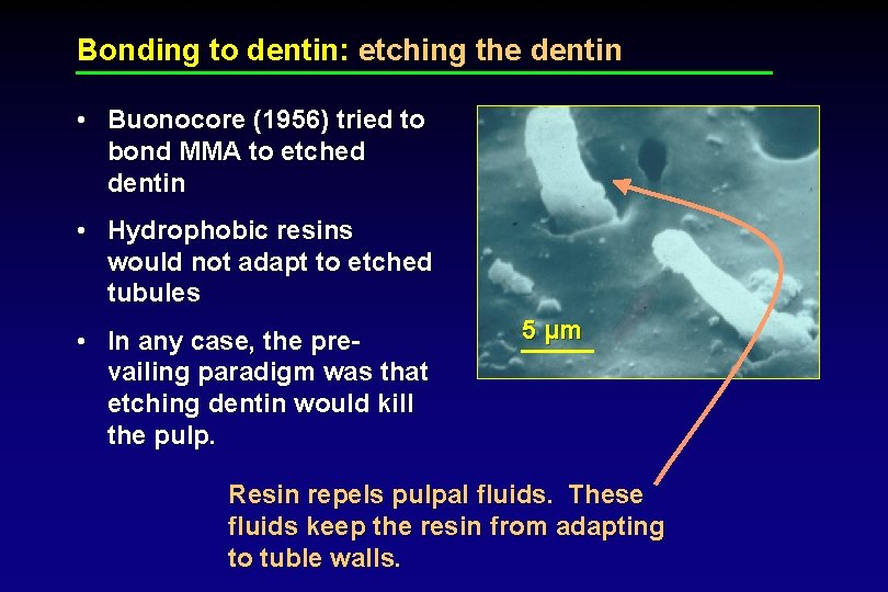 Bonding to dentin: etching the dentin • Buonocore (1956) tried to bond MMA to