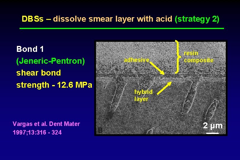 DBSs – dissolve smear layer with acid (strategy 2) Bond 1 (Jeneric-Pentron) shear bond