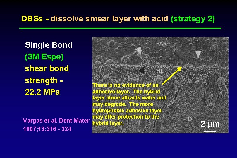 DBSs - dissolve smear layer with acid (strategy 2) Single Bond (3 M Espe)