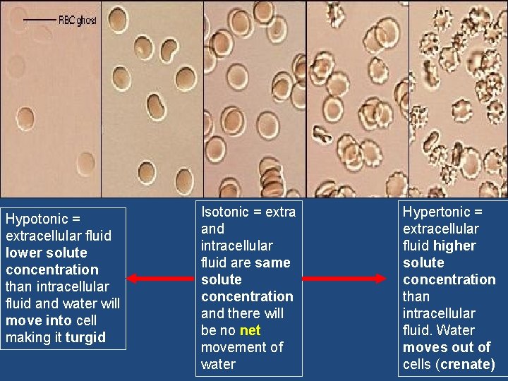 Hypotonic = extracellular fluid lower solute concentration than intracellular fluid and water will move