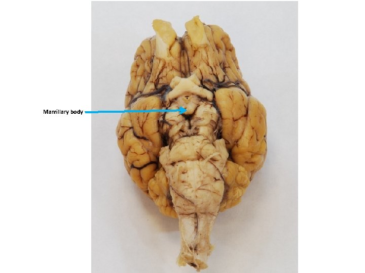 Mamillary body 