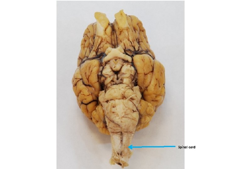 Spinal cord 