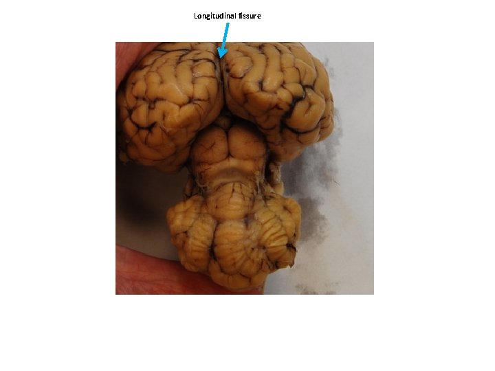 Longitudinal fissure 