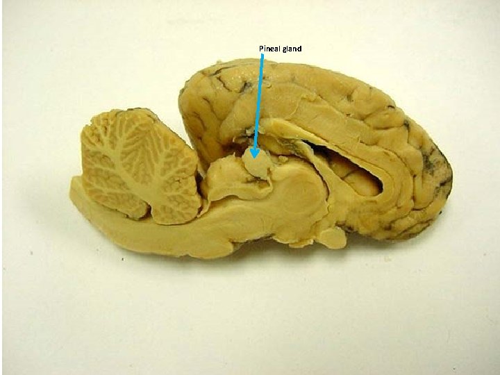 Pineal gland 