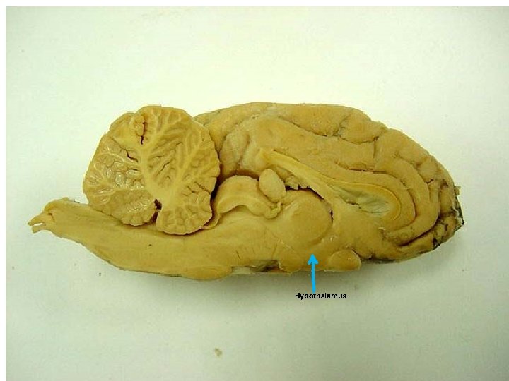 Hypothalamus 