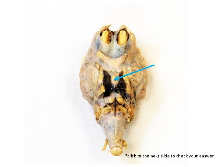 *click to the next slide to check your answer 