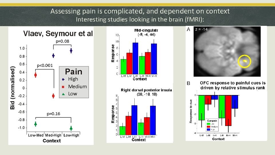 Assessing pain is complicated, and dependent on context Interesting studies looking in the brain