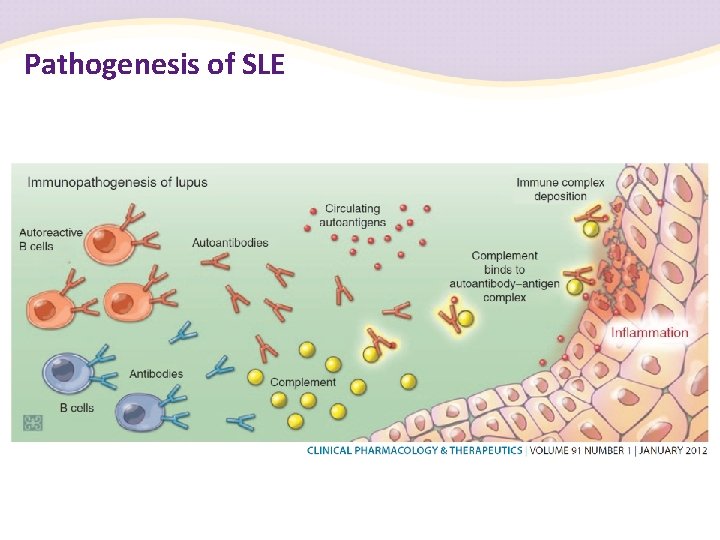 Pathogenesis of SLE 