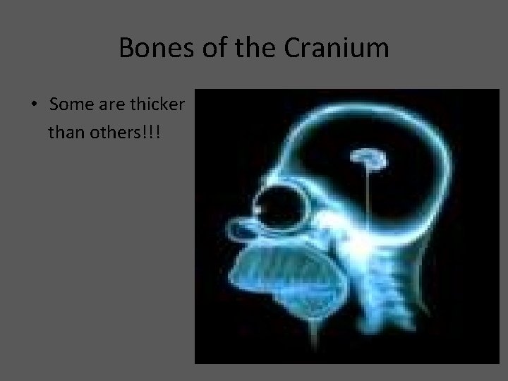 Bones of the Cranium • Some are thicker than others!!! 