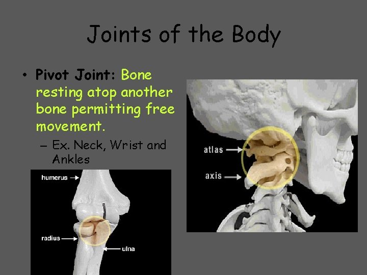 Joints of the Body • Pivot Joint: Bone resting atop another bone permitting free