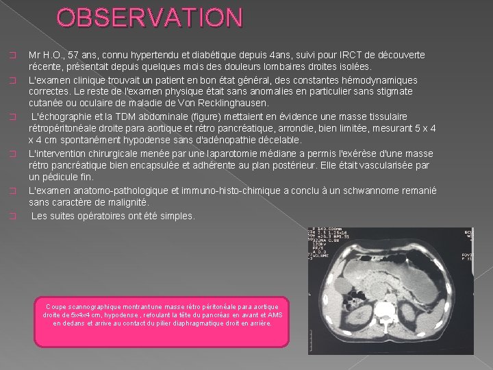 OBSERVATION � � � Mr H. O. , 57 ans, connu hypertendu et diabétique