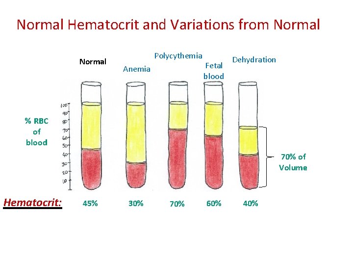 Normal Hematocrit and Variations from Normal Polycythemia Anemia Fetal blood Dehydration % RBC of