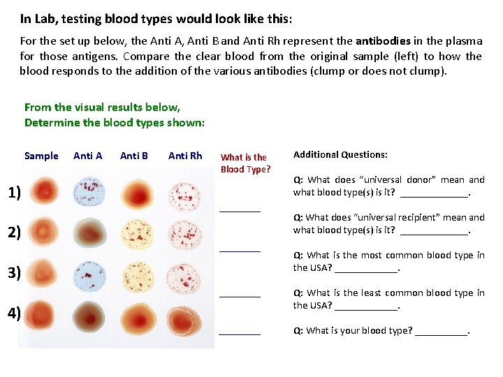 In Lab, testing blood types would look like this: For the set up below,