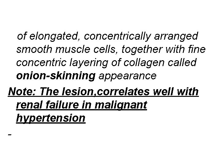 of elongated, concentrically arranged smooth muscle cells, together with fine concentric layering of collagen of elongated, concentrically arranged smooth muscle cells, together with fine concentric layering of collagen