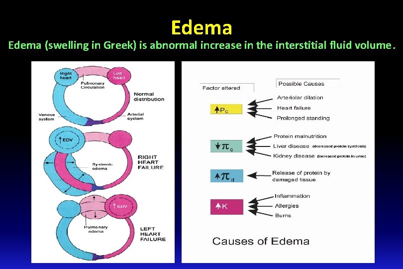 Edema (swelling in Greek) is abnormal increase in the interstitial fluid volume. 