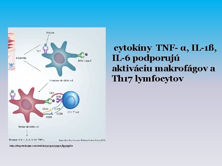 cytokíny TNF- α, IL-1ß, IL-6 podporujú aktiváciu makrofágov a Th 17 lymfocytov http: //img.