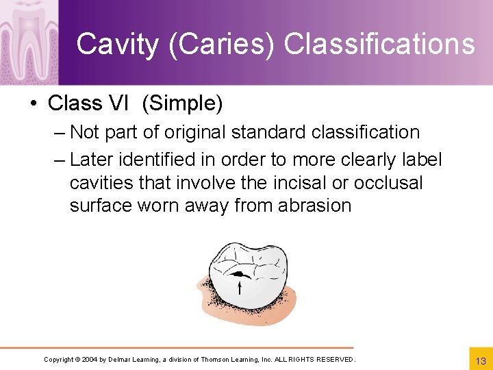 Cavity (Caries) Classifications • Class VI (Simple) – Not part of original standard classification