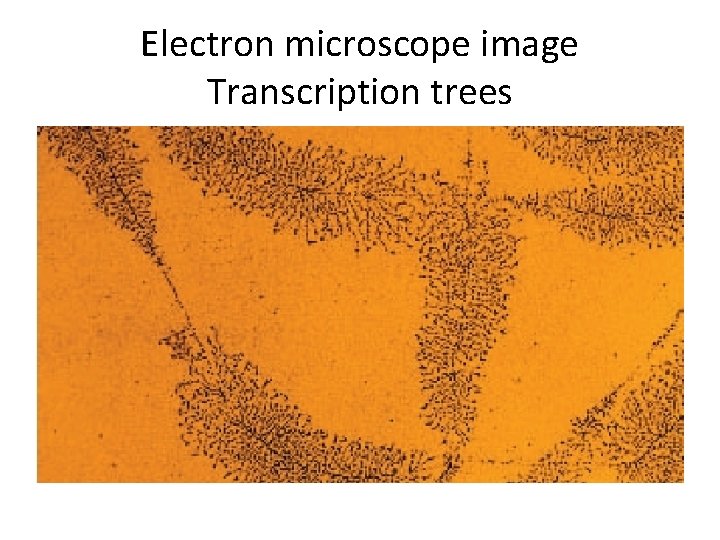Electron microscope image Transcription trees 