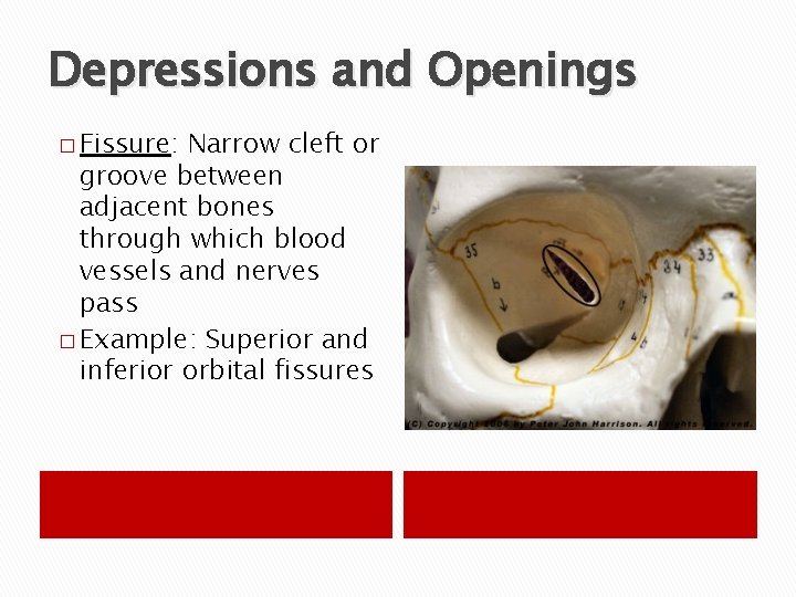 Depressions and Openings � Fissure: Narrow cleft or groove between adjacent bones through which